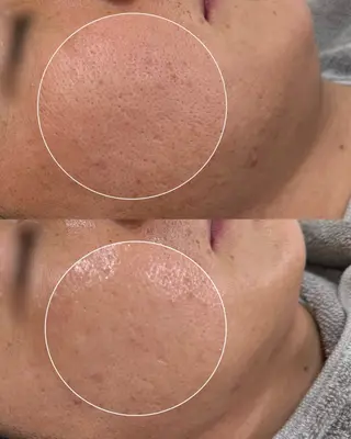 メンズ laksmi 陶肌トリートメントのエステ・リラクイメージ