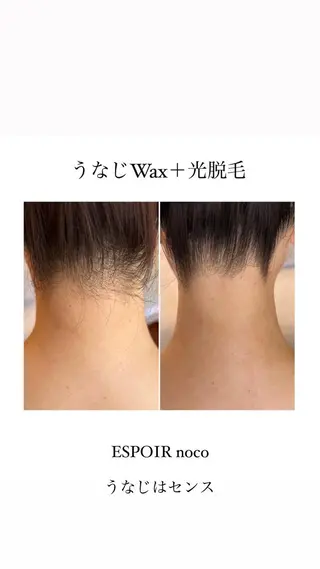ワックス脱毛🌈 ESPOIRnocoのエステ・リラクイメージ