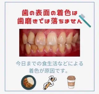 ホワイトニングショップ伊丹店所属・ホワイトニング ショップ伊丹店のその他イメージ