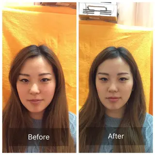 美容鍼・整体 根本改善/小林幸司のエステ・リラクイメージ