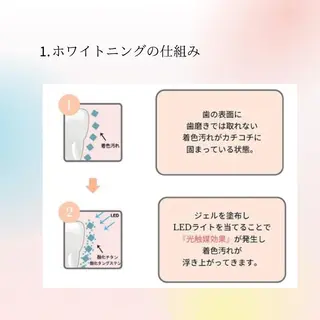 ホワイトニングシャトン所属・ホワイトニング シャトンのその他イメージ