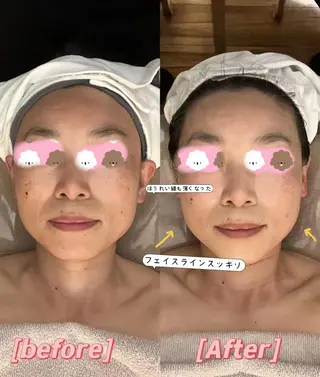 美肌小顔コルギ&瘦身 KOKOCHIのエステ・リラクイメージ