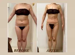 Prima〜プリマ〜 名古屋駅店所属・Prima 痩身脱毛 にごうかおりのエステ・リラクイメージ