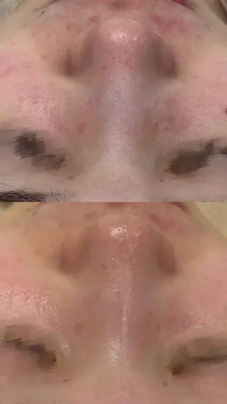 ナリスビューティーステーション De I'm 西尾店所属・鈴木 りいなのエステ・リラクイメージ