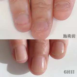 木村 千晴のネイルデザイン