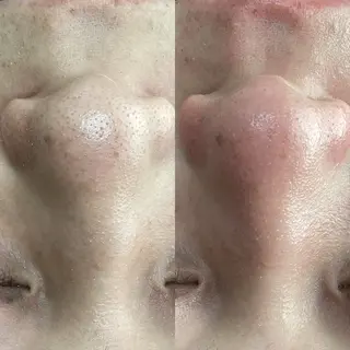 Rifuro毛穴ケア &よもぎ蒸しサロンの眉毛・アイブロウイメージ