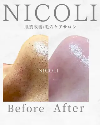 エステサロン NICOLIのエステ・リラクイメージ