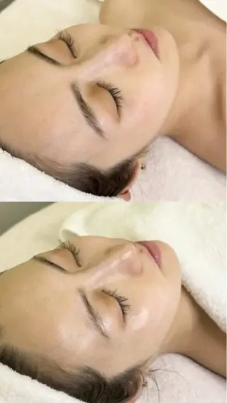 美容鍼灸サロン mahoroba院長のエステ・リラクイメージ