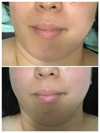 武蔵浦和　小顔矯正 リーフ　　武蔵浦和店のエステ・リラクイメージ