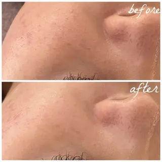 メンズ メナード岐阜茜部 杉浦のエステ・リラクイメージ