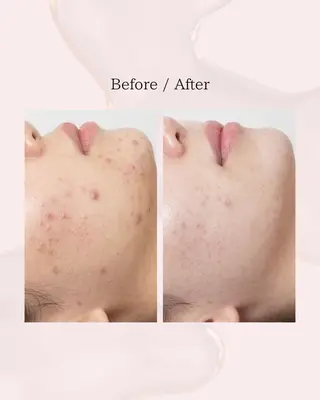 myherb所属・ニキビ肌改善サロン myherb🌿のエステ・リラクイメージ