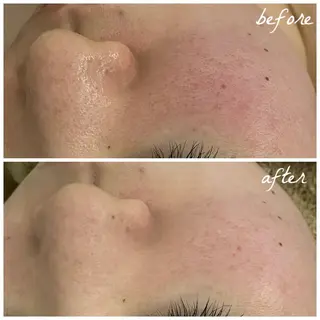 メンズ メナード岐阜市茜部 杉浦のエステ・リラクイメージ