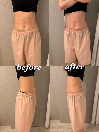 腸活サポート みなみののエステ・リラクイメージ