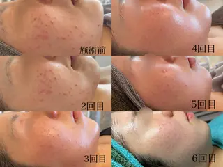 潤い艶肌/肌質改善 YUKAのエステ・リラクイメージ