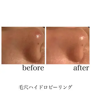 脱毛&エステサロン JIGGLY武蔵小山のエステ・リラクイメージ