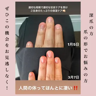 ネイル etoi所属・elmu (エルミュ)　本杉望のネイルデザイン