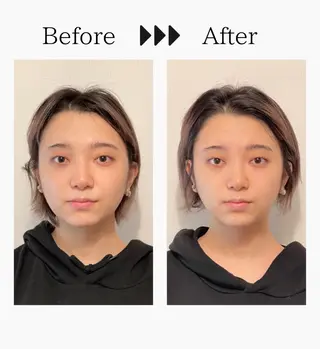 トータルサロンRuby所属・【医療提携】小顔 整体ハーブピーリングのその他イメージ