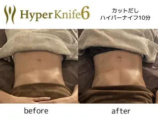 痩身サロンiBDY所属・いわきり ゆきのエステ・リラクイメージ