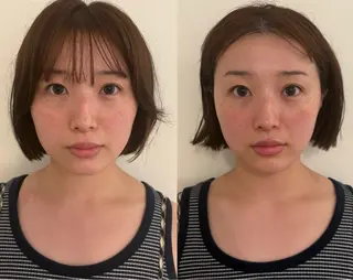 美容鍼灸サロン mahoroba院長のエステ・リラクイメージ