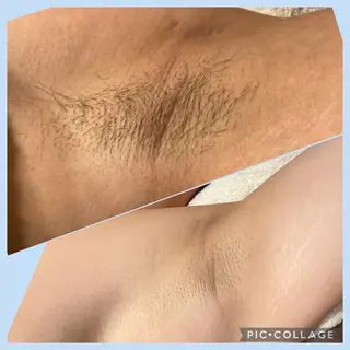 脱毛MAX南越谷所属・脱毛MAX 店長まなみのエステ・リラクイメージ