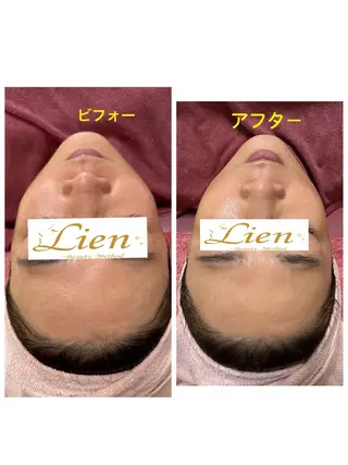 Lien オーナー　山口智嘉のエステ・リラクイメージ