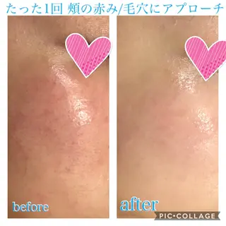 ショート カラー パーマ ヘアアレンジ メンズ キッズ ネイル マツエク・マツパ Ensor Clair所属・EnsorClair 代表　野口真央のエステ・リラクイメージ