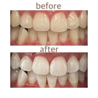 メンズ ホワイトニング ショップ船橋2号店のエステ・リラクイメージ