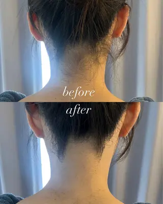 うなじ脱毛/美肌脱毛 LABELのエステ・リラクイメージ