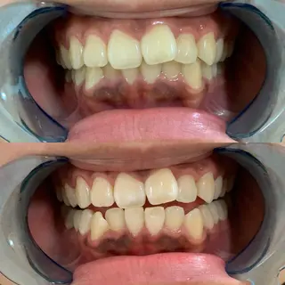 藤本 真心のネイルデザイン