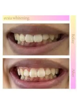 セルフホワイトニング エクシア西宮北口店所属・セルフホワイトニング エクシア西宮北口店のその他イメージ