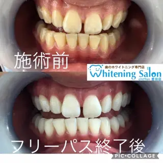 歯科レベルの白さ💎 ✨ホワイトニング豊田のエステ・リラクイメージ