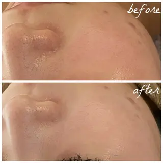 メンズ メナード岐阜市茜部 杉浦のエステ・リラクイメージ