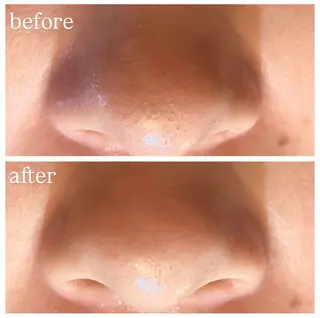 肌質改善専門 ハーブ /毛穴洗浄 リエイトのエステ・リラクイメージ