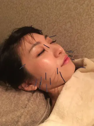 美容鍼サロン    Fleurir所属・伊藤 かなえのエステ・リラクイメージ