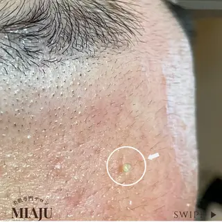 美肌専門サロン MIAJUのエステ・リラクイメージ