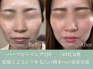 潤い艶肌／肌質改善 YUKAのエステ・リラクイメージ