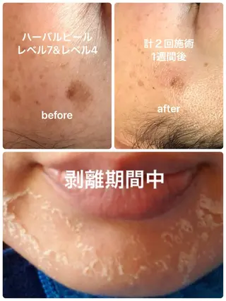 エステティック sala藤沢のエステ・リラクイメージ