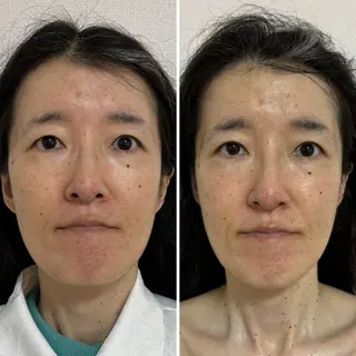 喜山 あつこのエステ・リラクイメージ