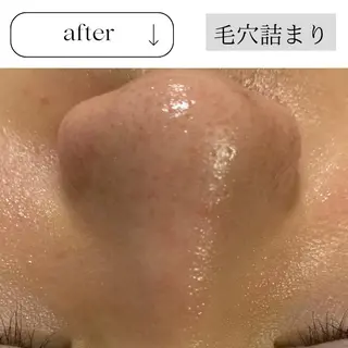 beauty CHOOSEのマツエク・マツパデザイン