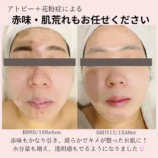 PRETTIEST SHINE所属・フェイシャル/ボディ /ブライダル山田浩子のエステ・リラクイメージ