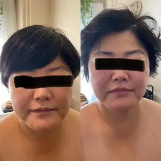 Meetite 小林のエステ・リラクイメージ