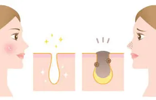 都度払い脱毛⭐️ 脱毛サロンMIRACのエステ・リラクイメージ