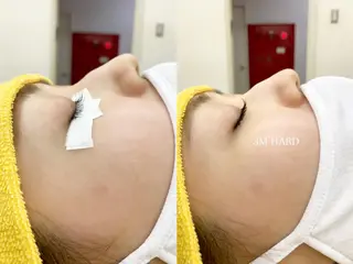 マツエク・マツパ 西岡 美香子のネイルデザイン