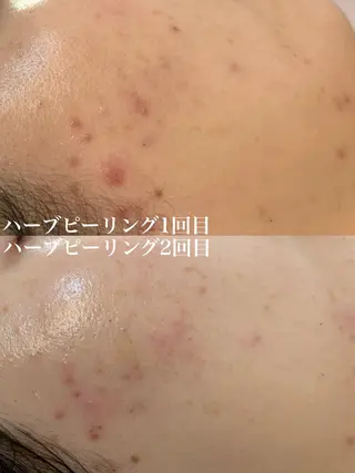 WHITE AQUA 北千住店のエステ・リラクイメージ