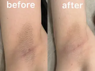 VIO /美肌専門サロン【Beauty  salon Bibiy】所属・VIO美肌専門サロン Bibiyのエステ・リラクイメージ