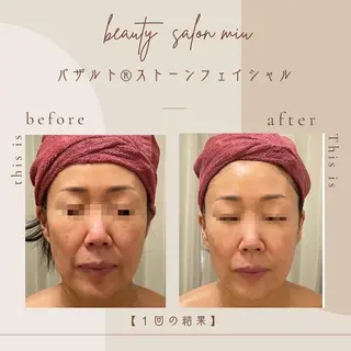 糸島 エステサロンmiuのエステ・リラクイメージ