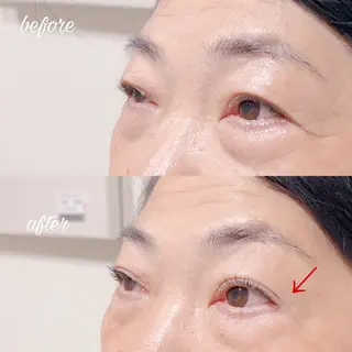 マツエク・マツパ merveilles所属・まつげ/整体/にきび ・アトピー専門サロンのマツエク・マツパデザイン