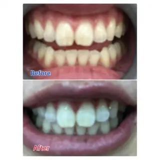 M渋谷店所属・M渋谷 ホワイトニングのエステ・リラクイメージ