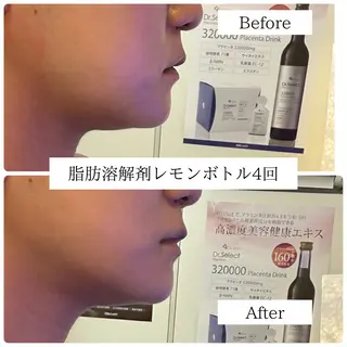 Lino me 島谷夢奈のエステ・リラクイメージ