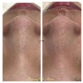 ビューティー ミロワールのエステ・リラクイメージ